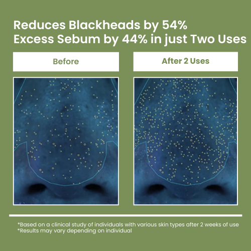 Gleame Holy Basil Mask