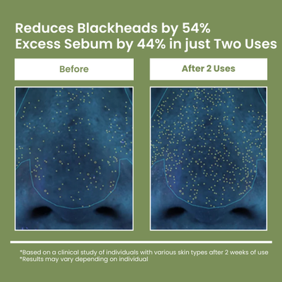 Gleame Holy Basil Mask