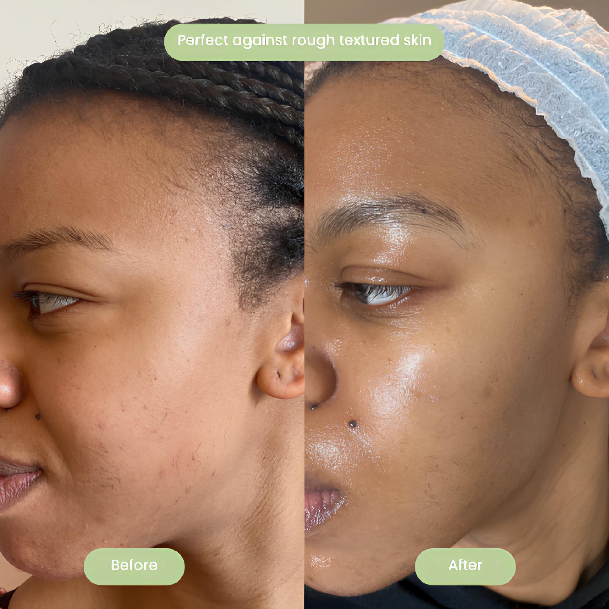 Gleame Holy Basil Mask