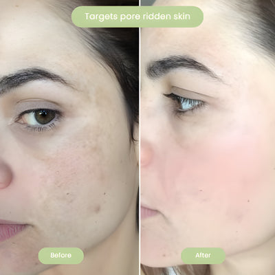 Gleame Holy Basil Mask